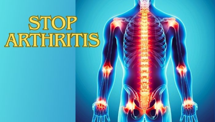 आमवात / Rheumatoid Arthritis