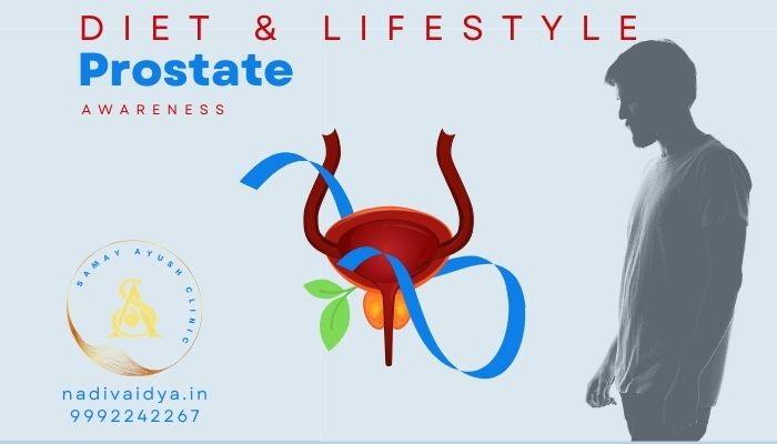 Prostate Health - Diet & Lifestyle
