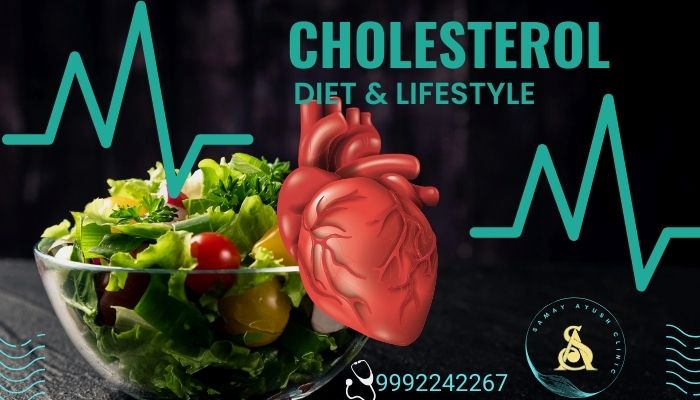 High Cholesterol - Diet & Lifestyle