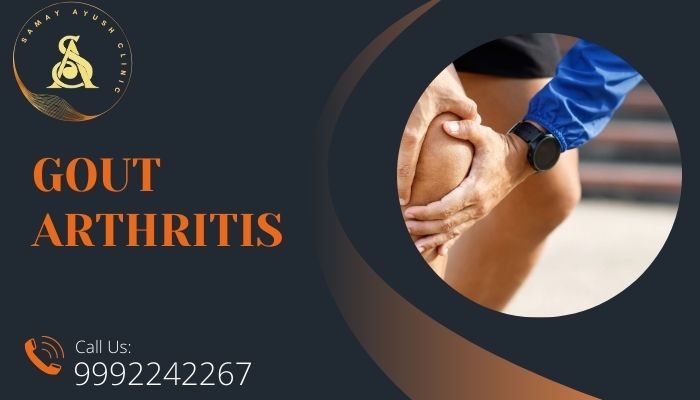 Gout Arthritis - Diet & Lifestyle
